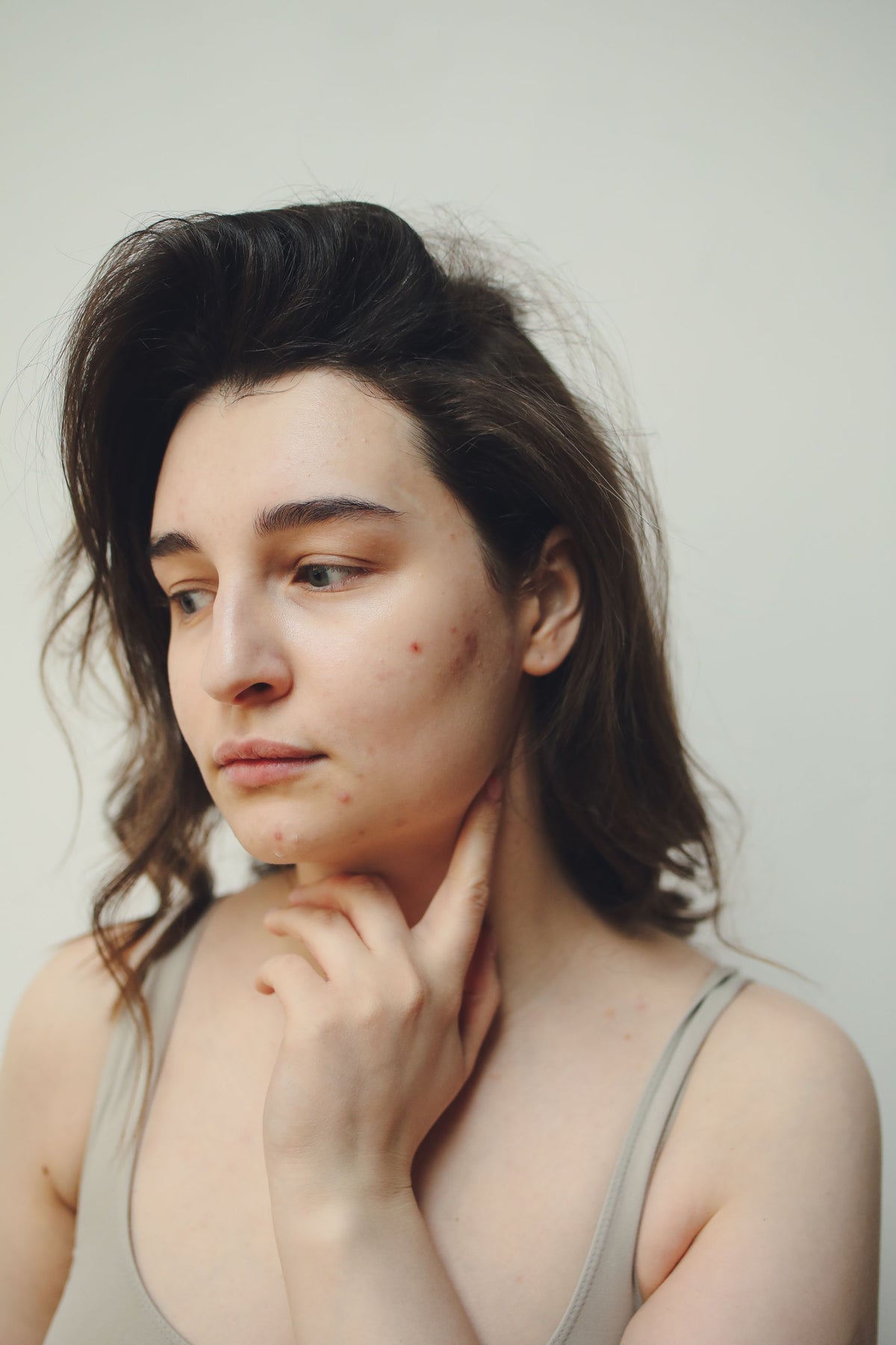 A close-up portrait of a woman with visible skin texture and acne.