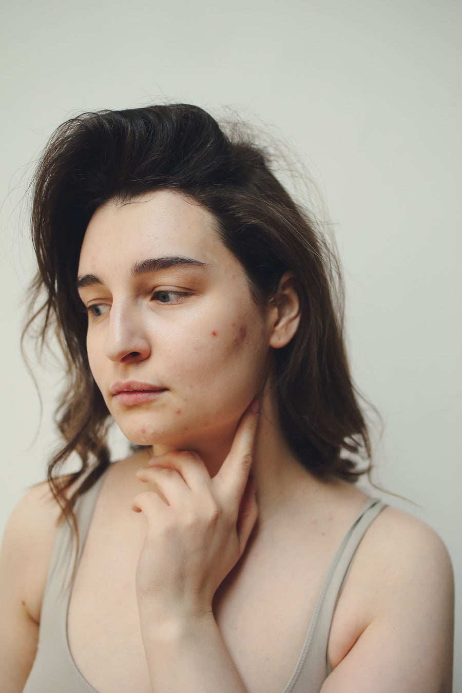 A close-up portrait of a woman with visible skin texture and acne.